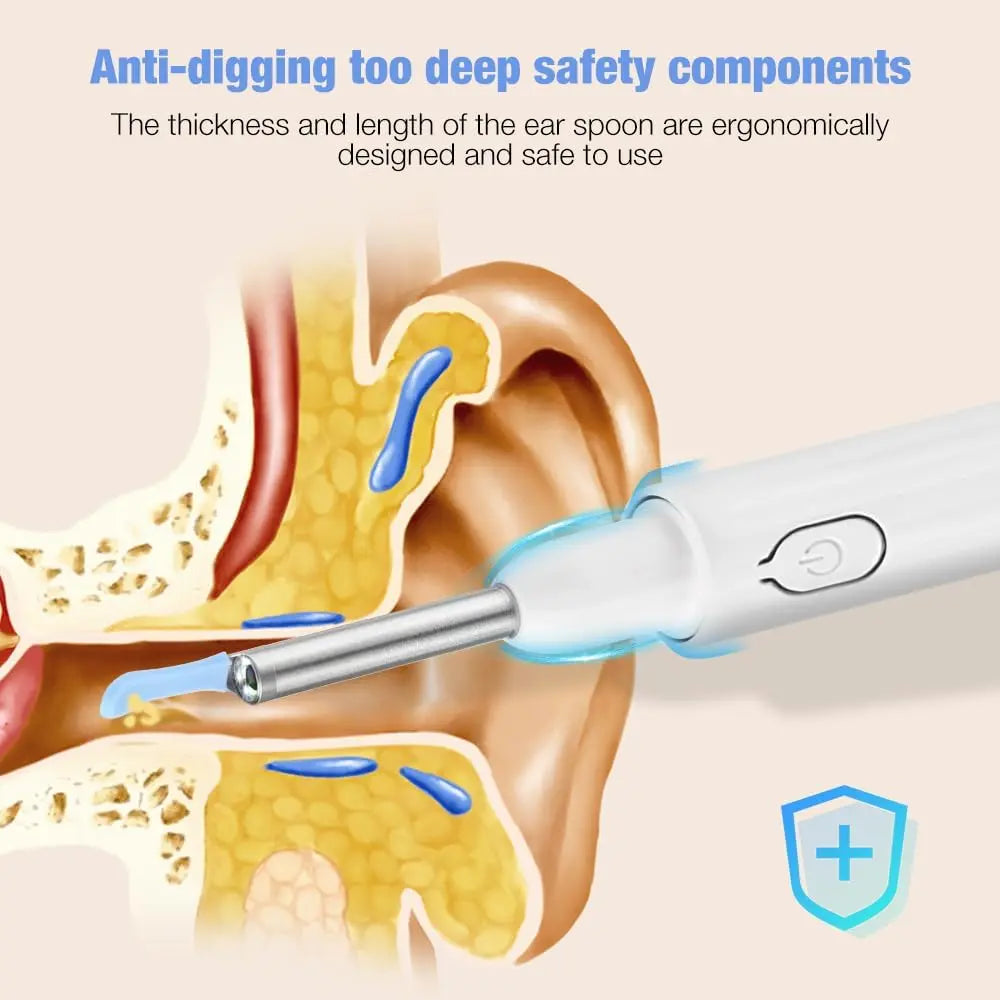 V88R Wireless Ear Cleaner with 5MP Camera, 6 LED Lights, Waterproof, Full HD Video Ear Endoscope Otoscope/Ear Wax Removal Cleaning Tool Kit